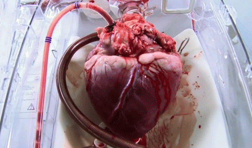 Gli altri pericoli per la salute del cuore