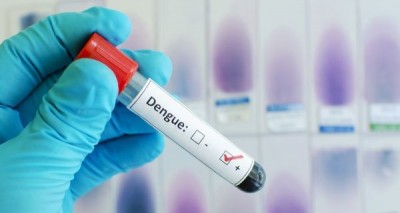 Nuovo caso di Dengue ad Arezzo: ordinata la disinfestazione intorno all’ospedale San Donato