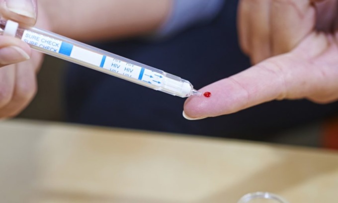 HIV e sifilide