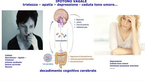 sindrome vagale